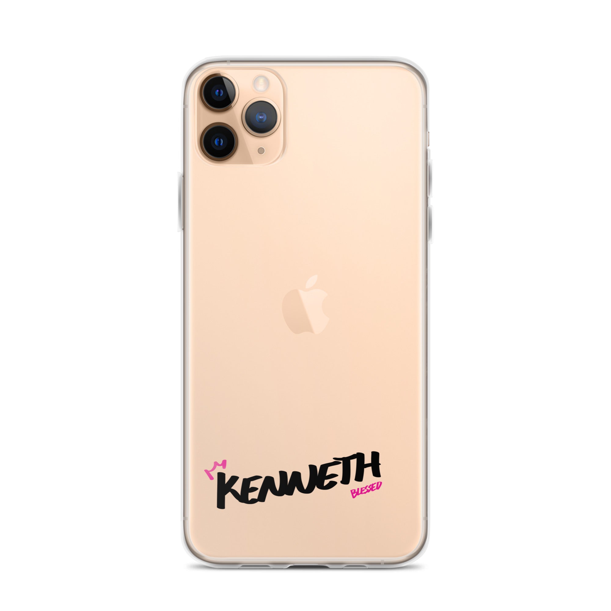 Clear iPhone Case - Kenneth Blessed