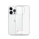 Clear iPhone Case White Text - Alan